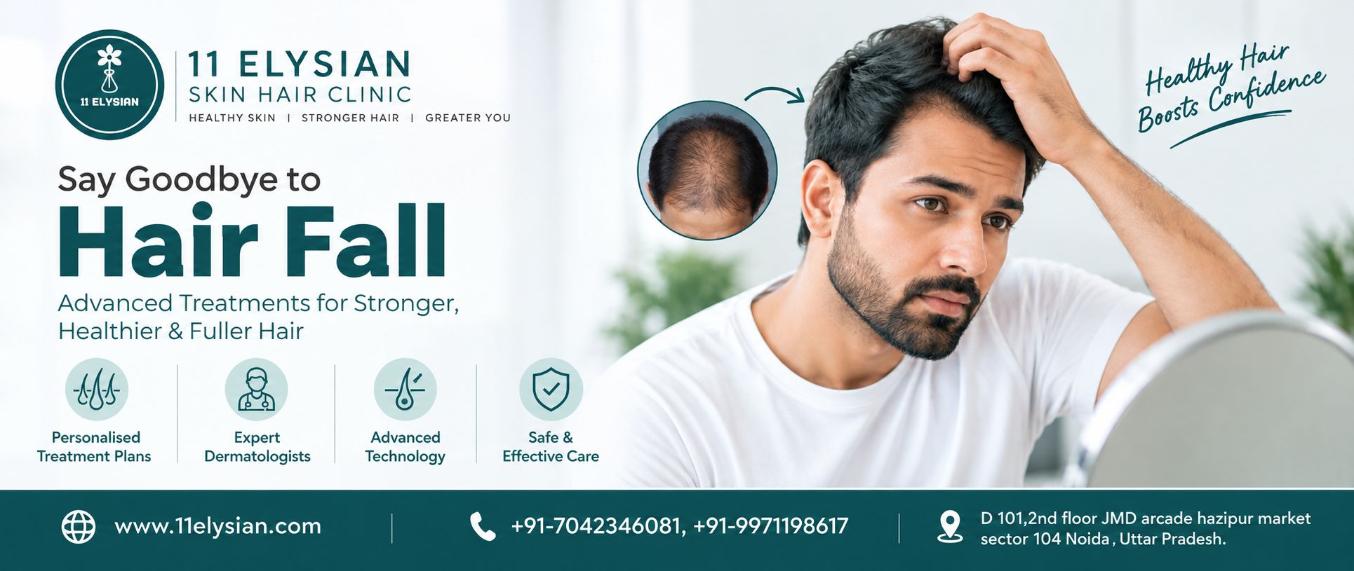 Hair Fall Treatment Near Sector 104, Noida
