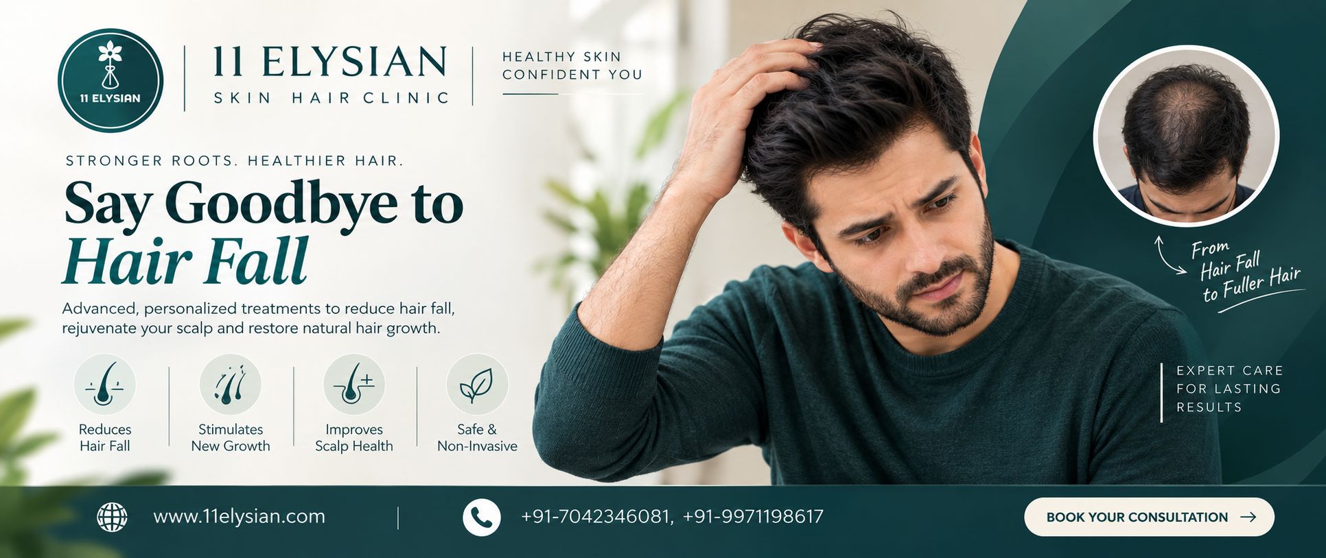 Hair Fall Treatment Near Sector 107, Noida