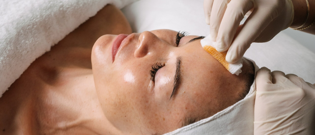 Sesglycolic Peel (tanning)