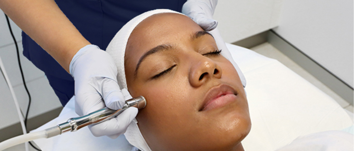 Microdermabrasion