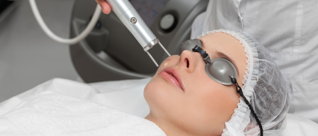 Pico Q Switch (Pigmentation)