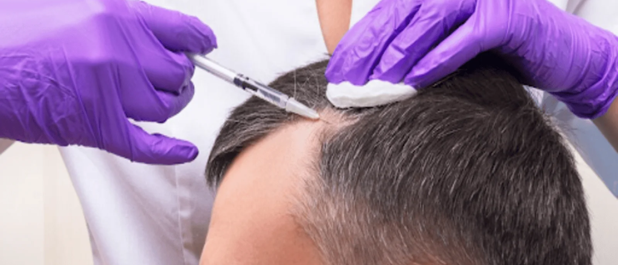 QR678 Hair Growth Treatment